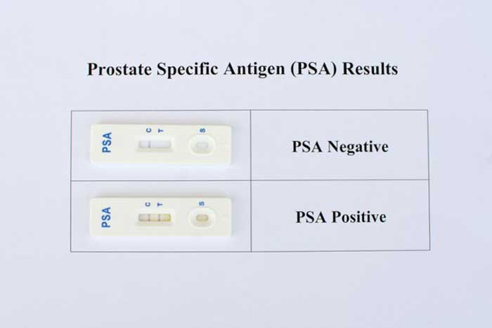 Prostate-specific antigen