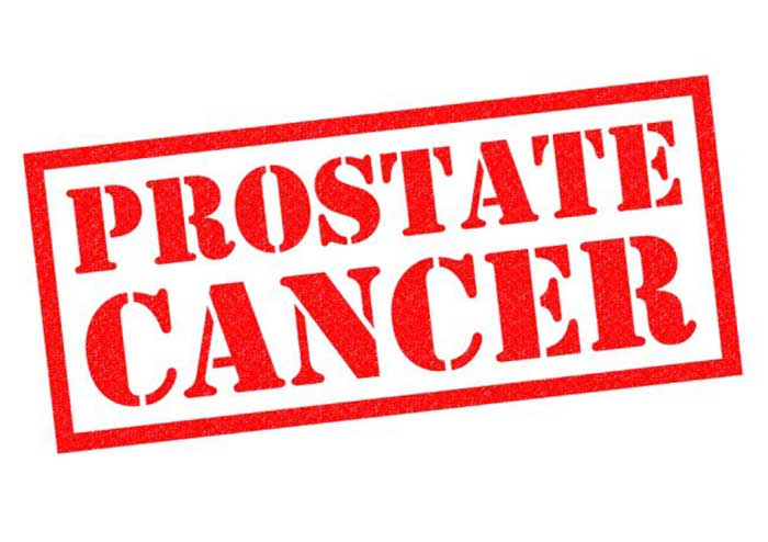 Prostate Cancer Illustration