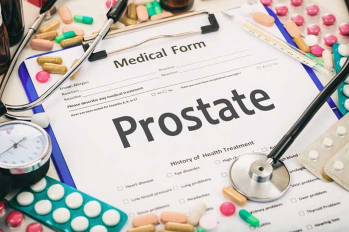 Spotlight on Prostatic Intraepithelial Neoplasia