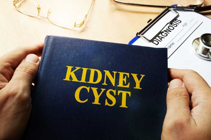 KIDNEY CYSTS