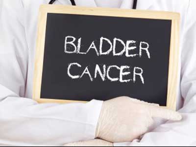 Bladder Cancer