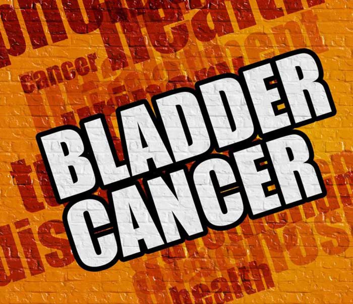 Bladder Cancer