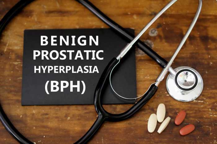 Benign prostatic hyperplasia (BPH)