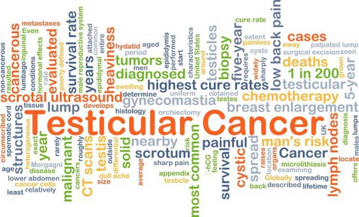 Testicular Cancer Treatment Options