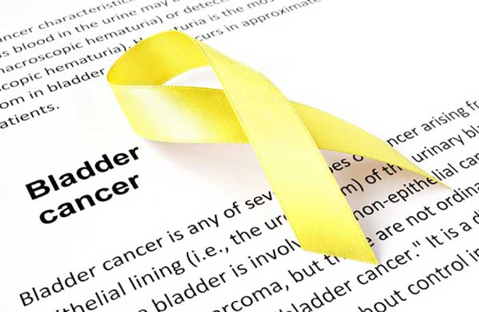 Bladder Cancer